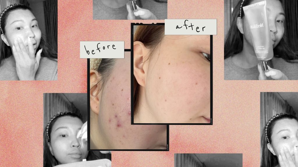 Retinol Serums Transformed My Skin—Meet My Go-To Formulas